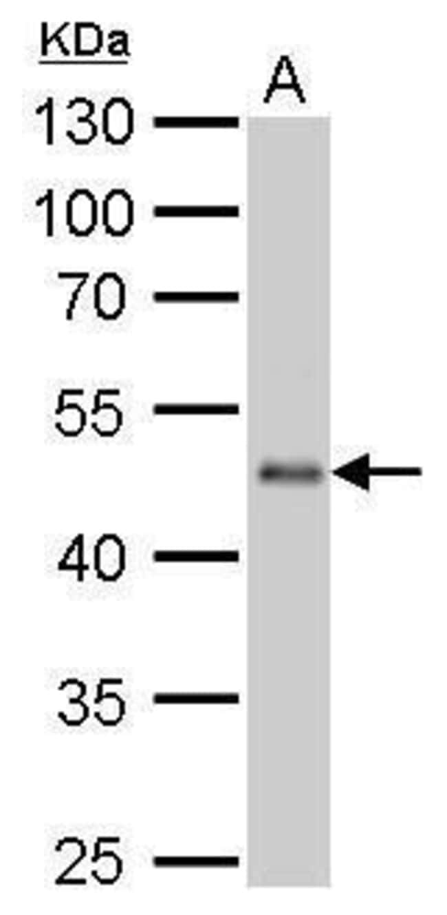 ANTI-EEF1A2