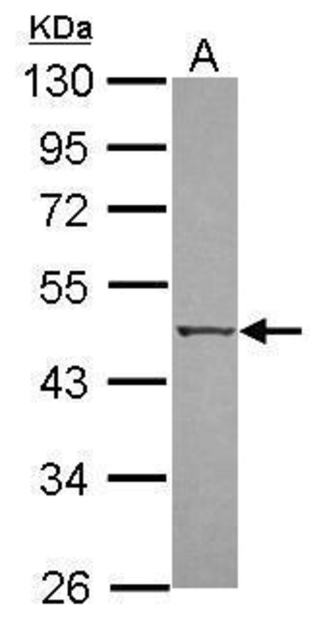 ANTI-DAP KINASE 3