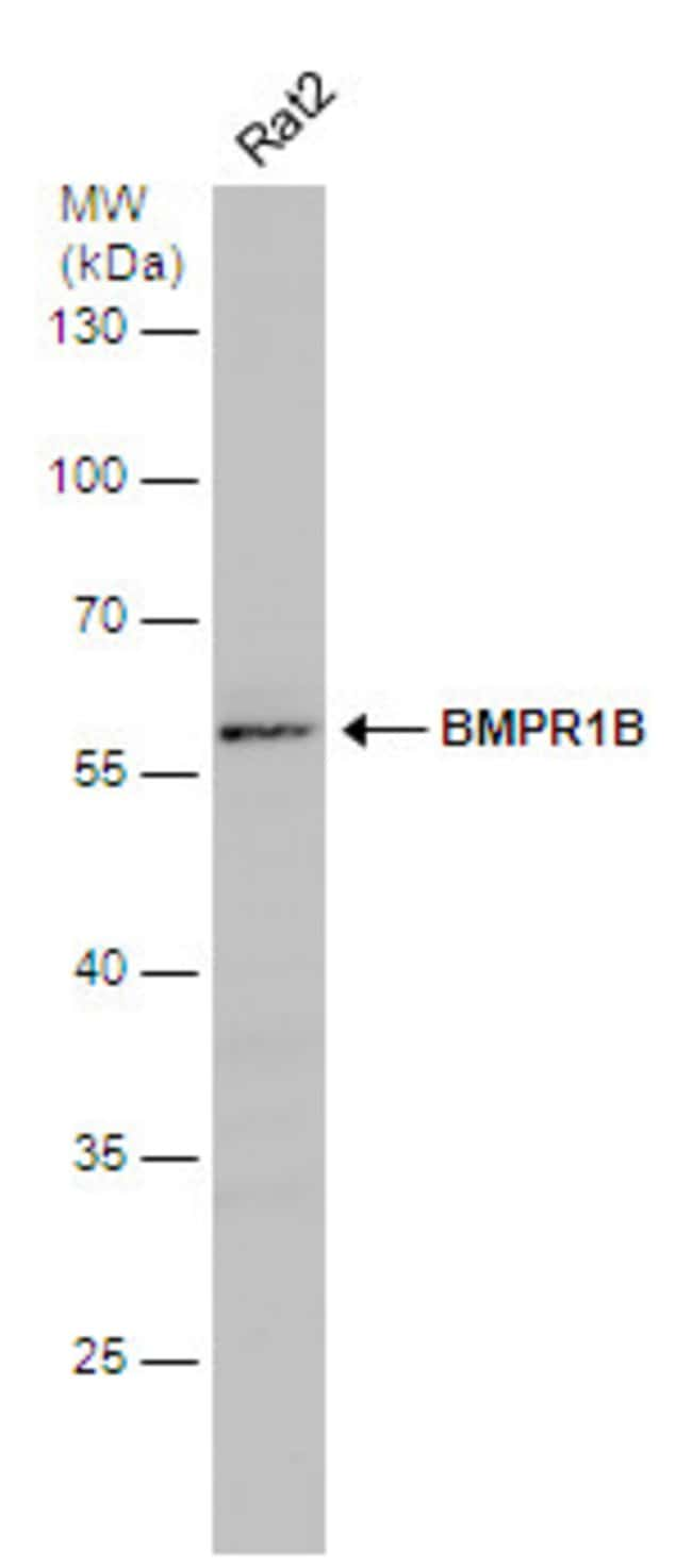 ANTI-BMPR1B