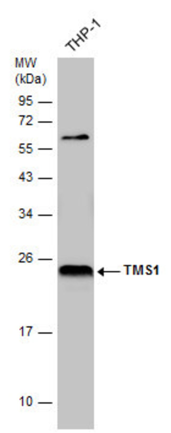 ANTI-TMS1