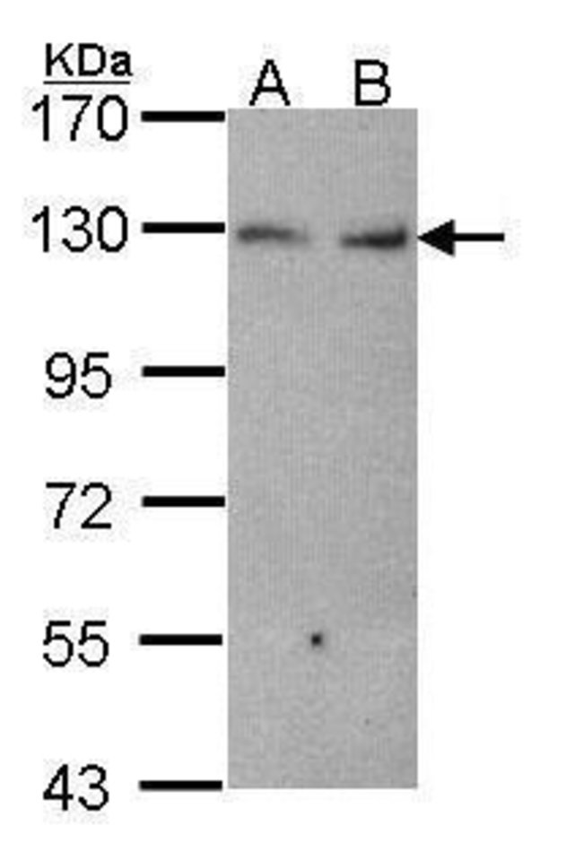 ANTI-K-CADHERIN