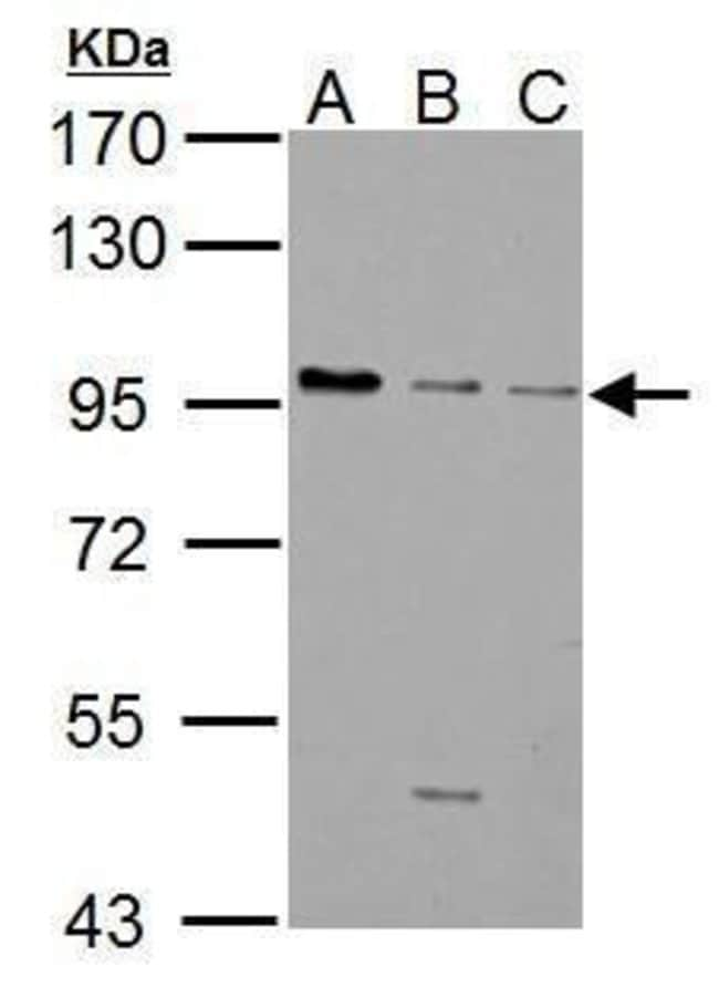 ANTI-GABA B RECEPTOR 1