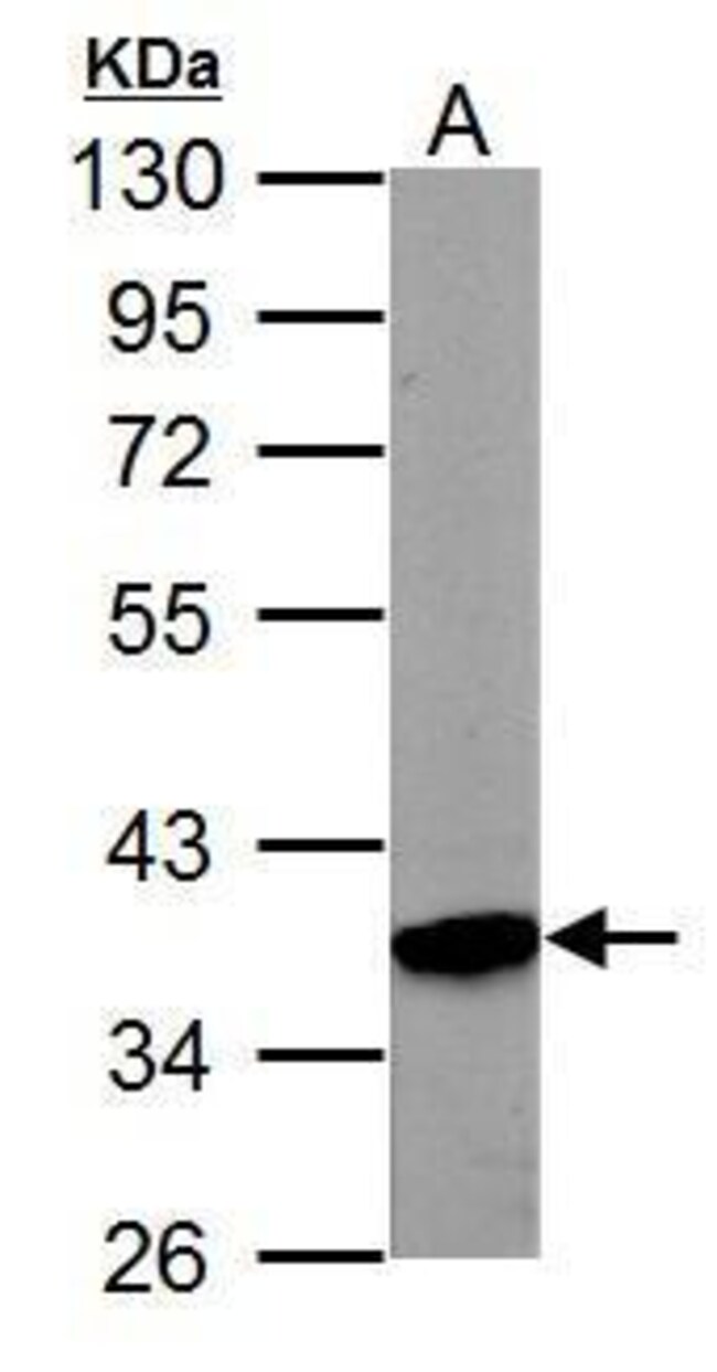 ANTI-PRPS1