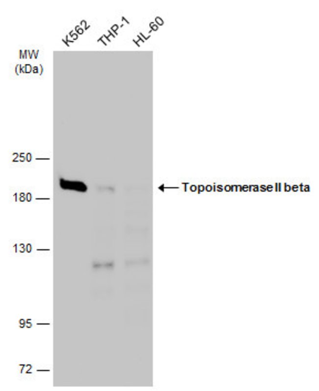 ANTI-TOPOISOMERASE II BETA