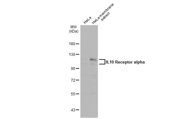 ANTI-IL10 RECEPTOR ALPHA