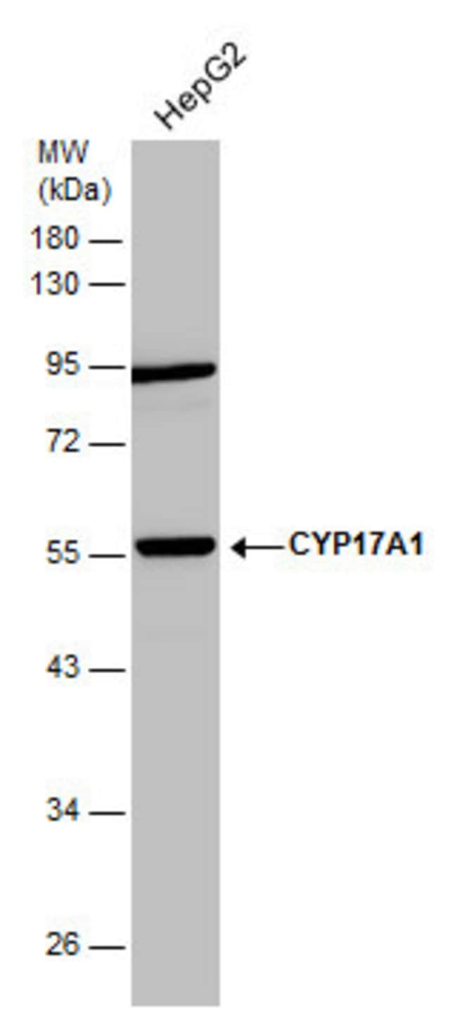 ANTI-CYP17A1