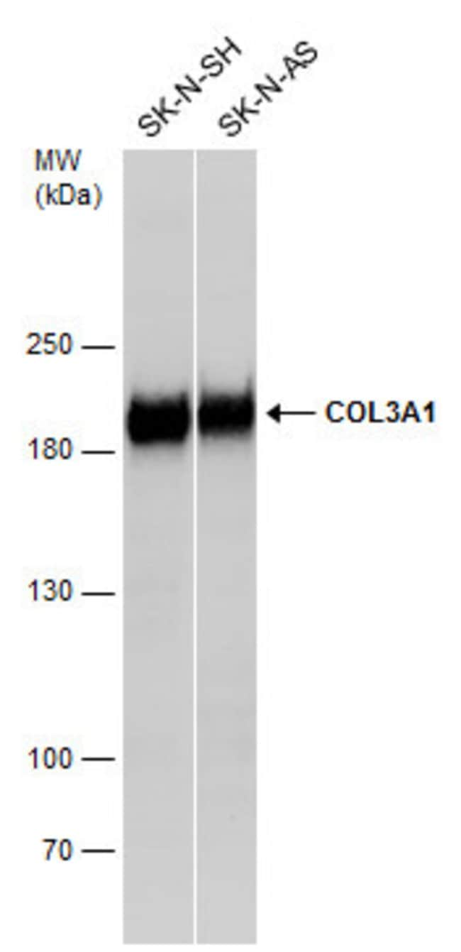 ANTI-COL3A1