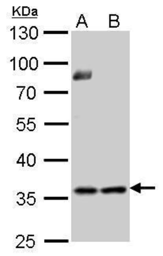 ANTI-THYMIDYLATE SYNTHETASE