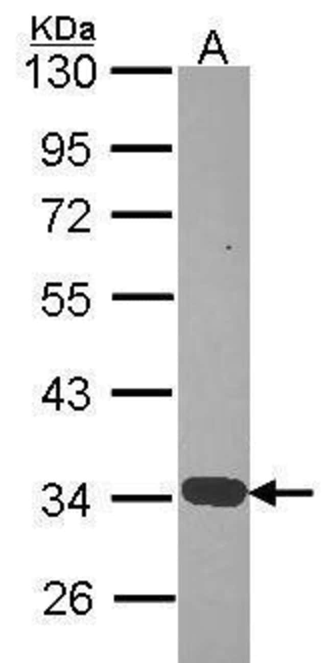 ANTI-ANNEXIN A4