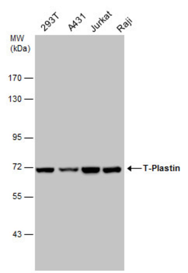 ANTI-T-PLASTIN