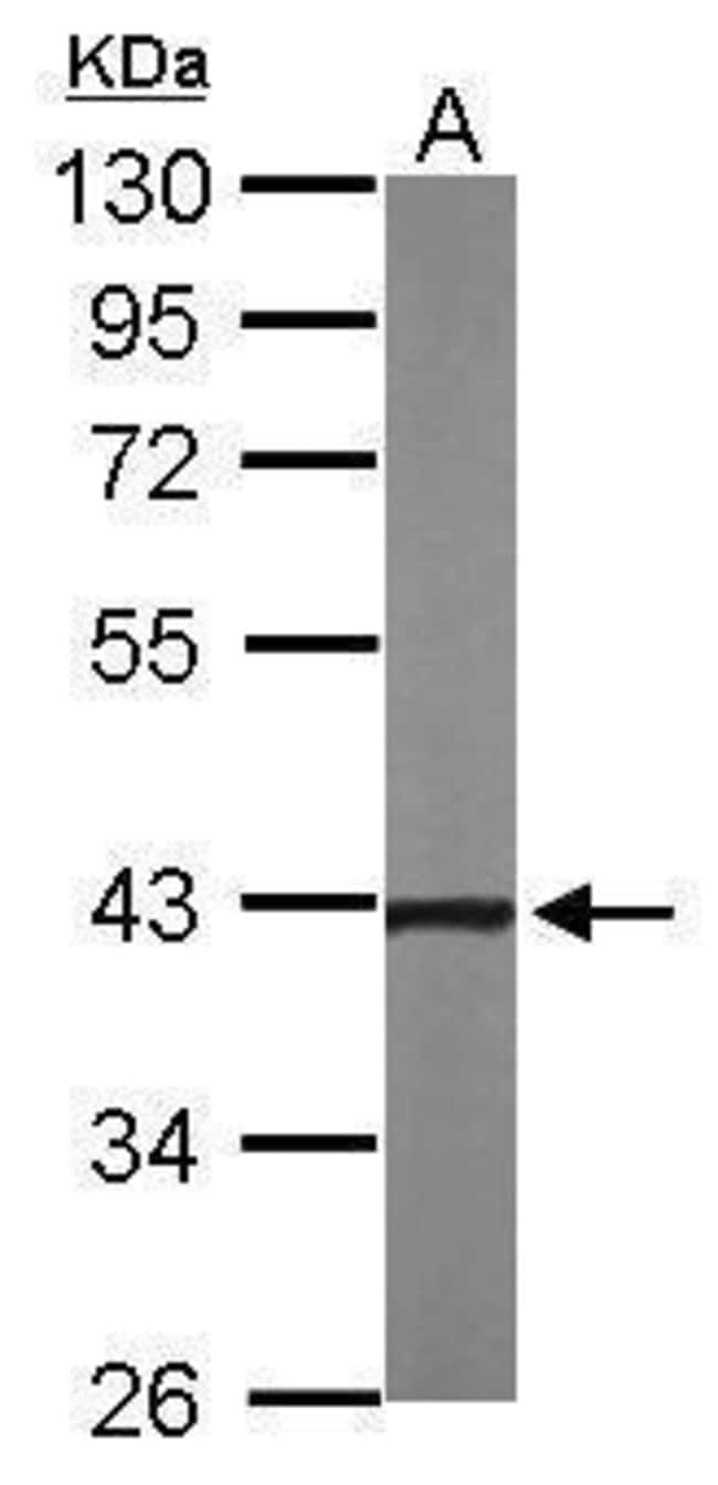 ANTI-CCN3