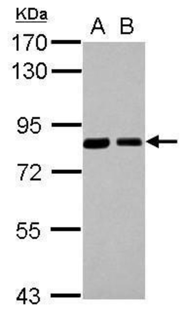 ANTI-SNX9