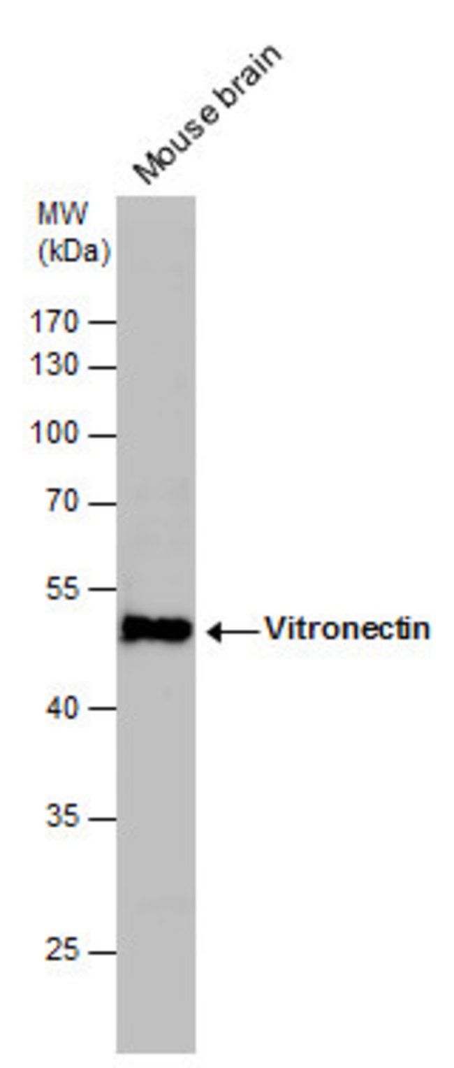 ANTI-VITRONECTIN