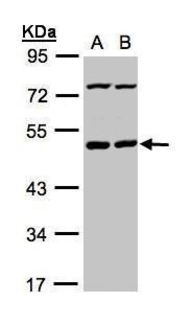 ANTI-PSKH1