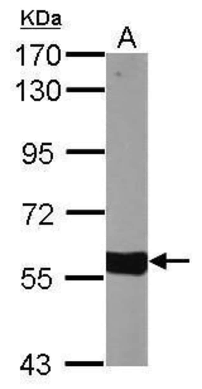 ANTI-CYP27A1