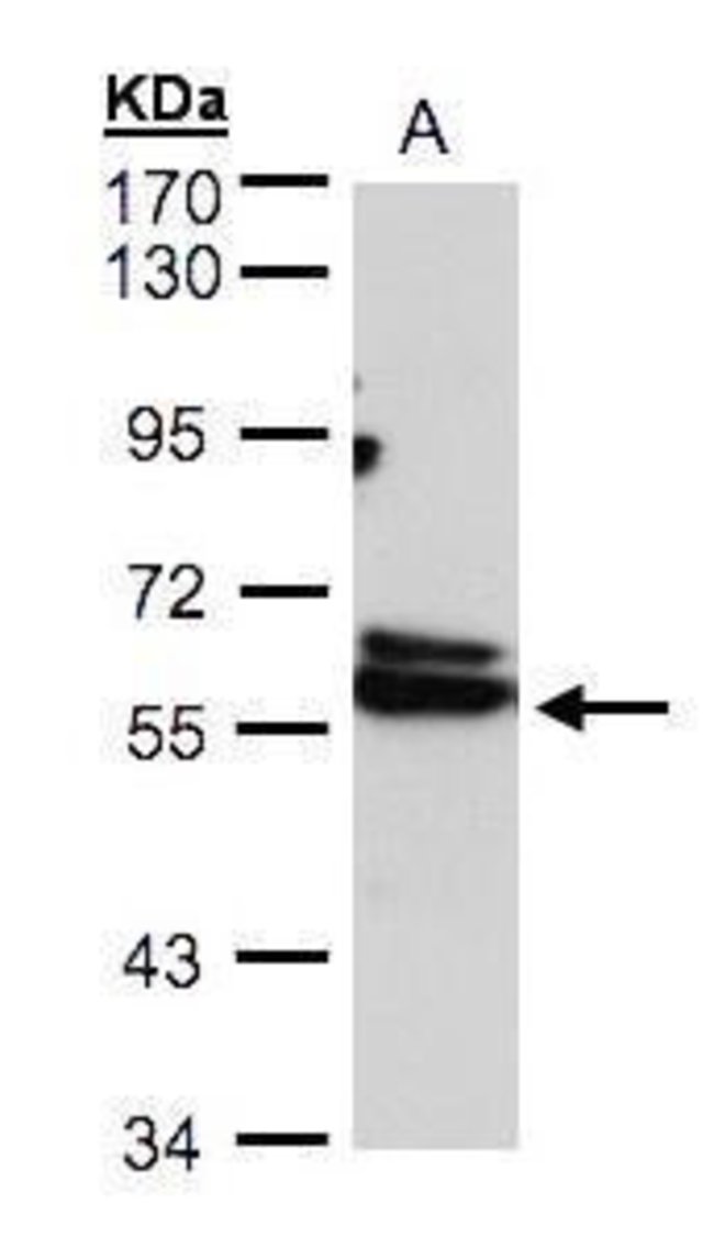 ANTI-TCP-1 DELTA