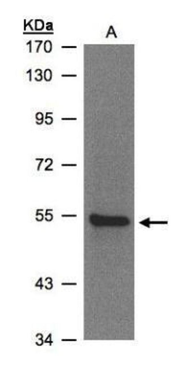 ANTI-ZNF157