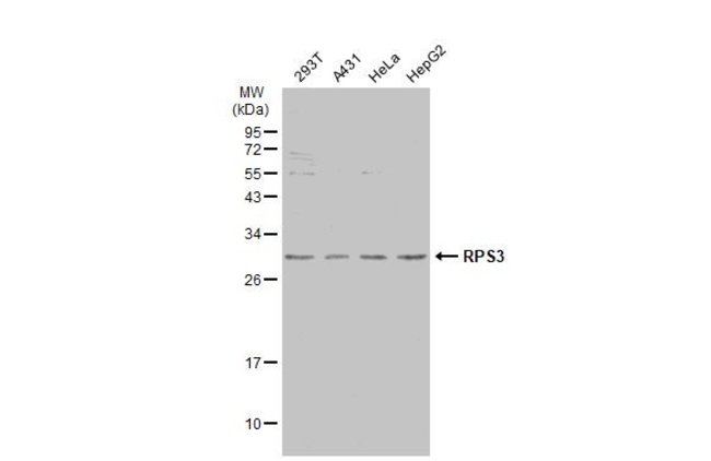 ANTI-RPS3