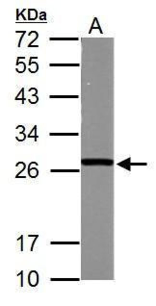 ANTI-GSTM5