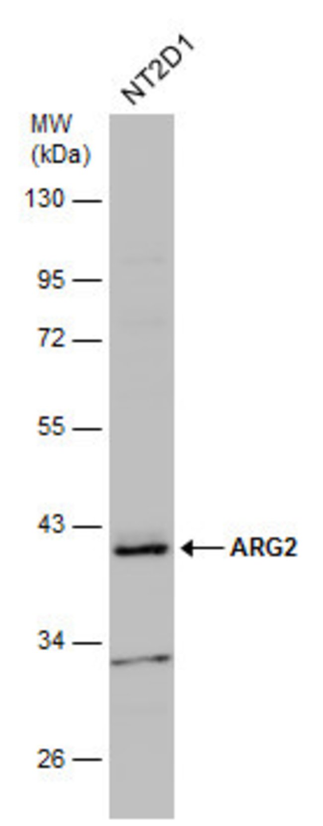 ANTI-ARGINASE II