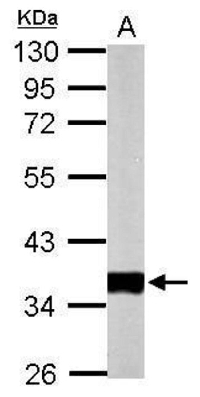 ANTI-PYRUVATE DEHYDROGENASE E1 BETA SUBU