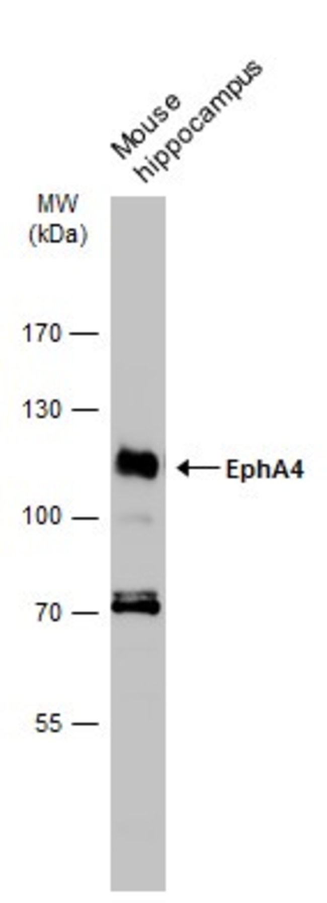 ANTI-EPH RECEPTOR A4