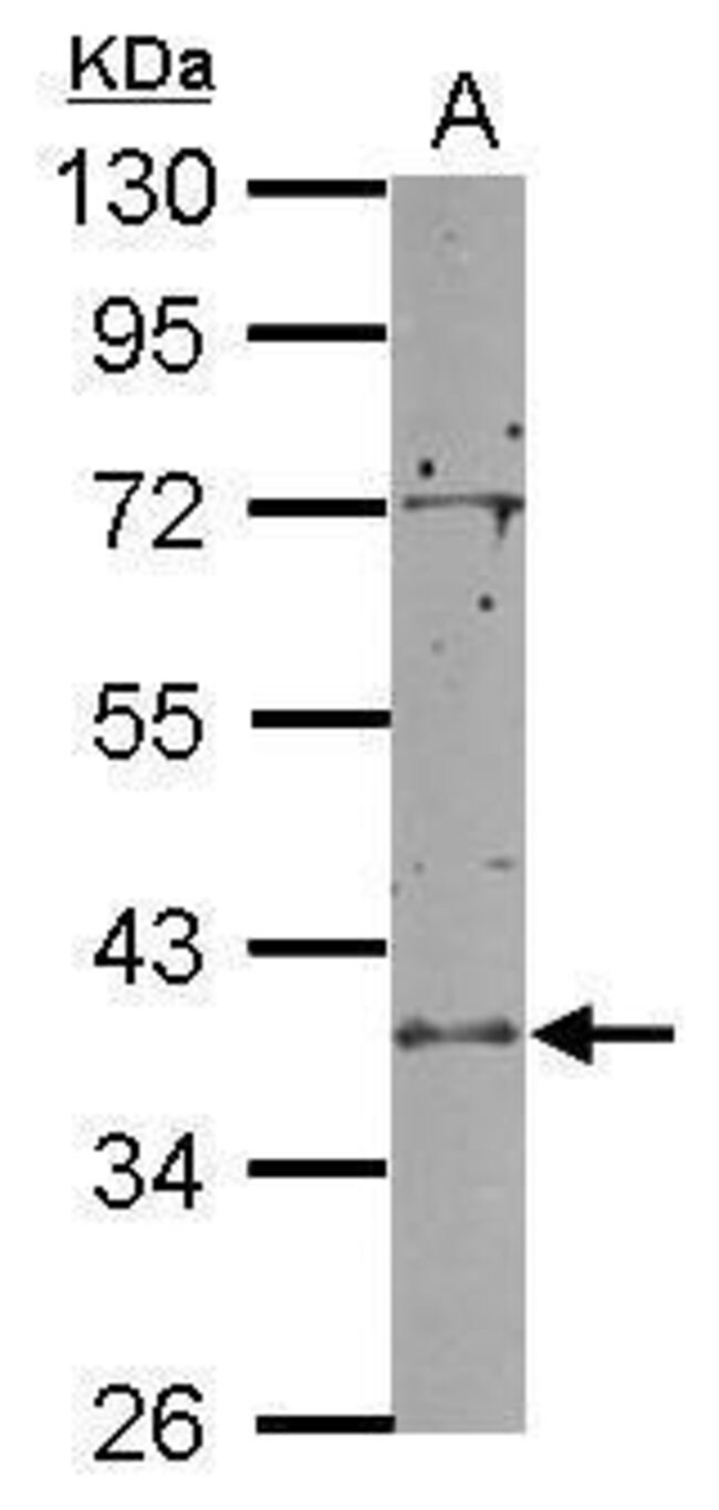 ANTI-RCL1