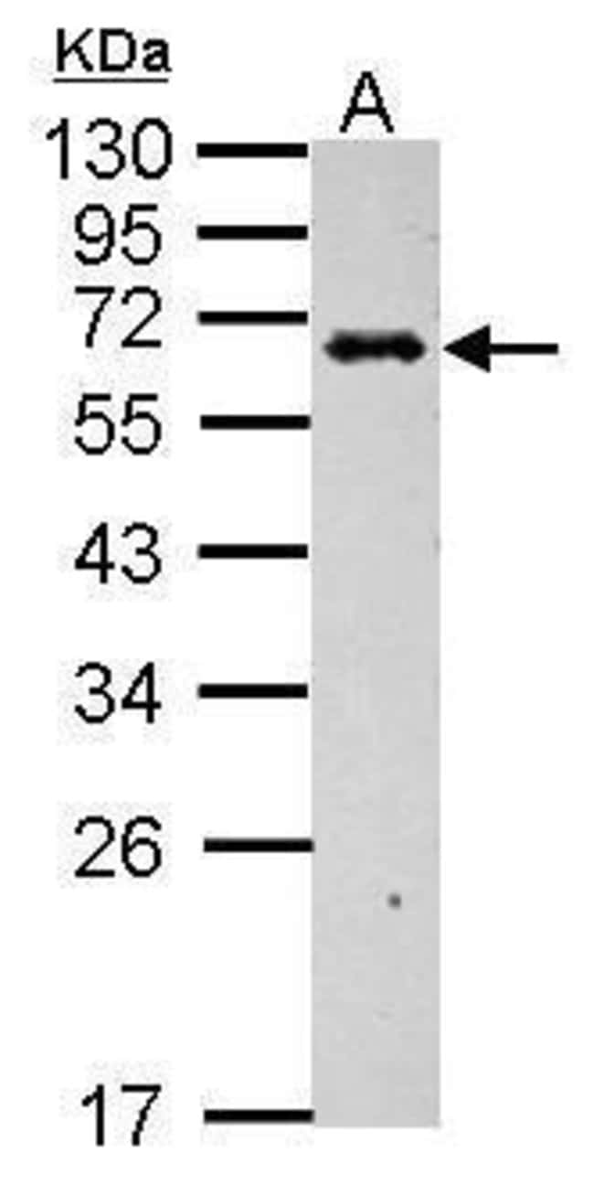 ANTI-C4 BINDING PROTEIN B