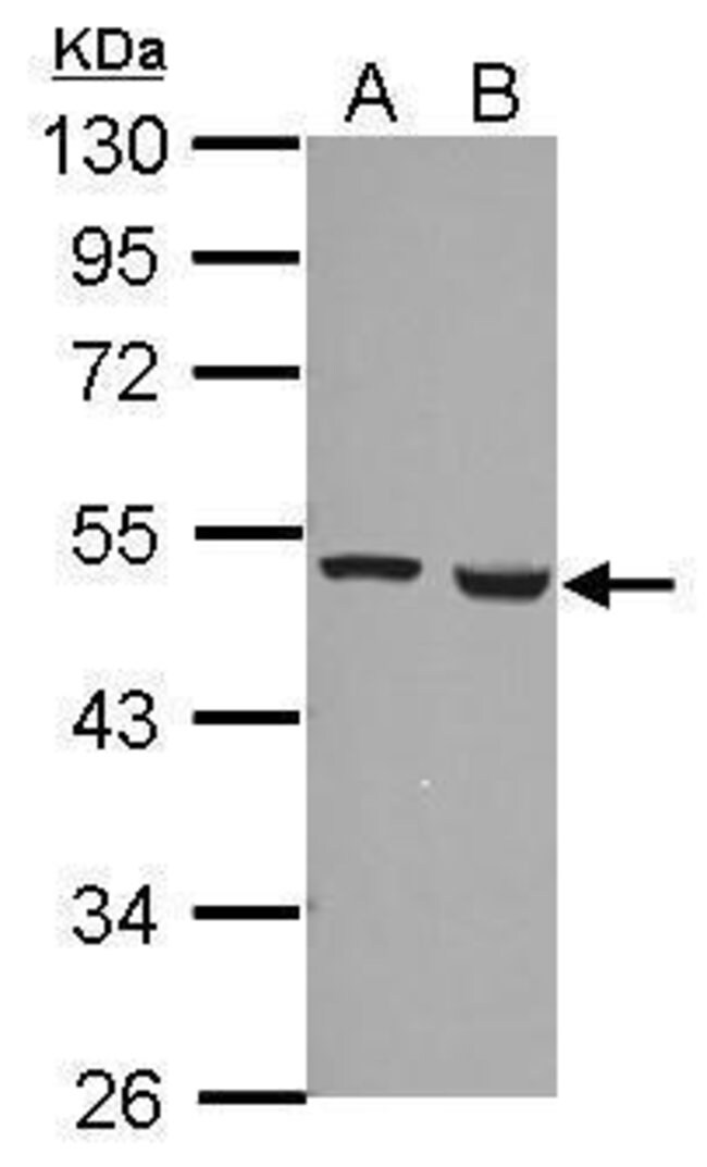 ANTI-FERREDOXIN REDUCTASE