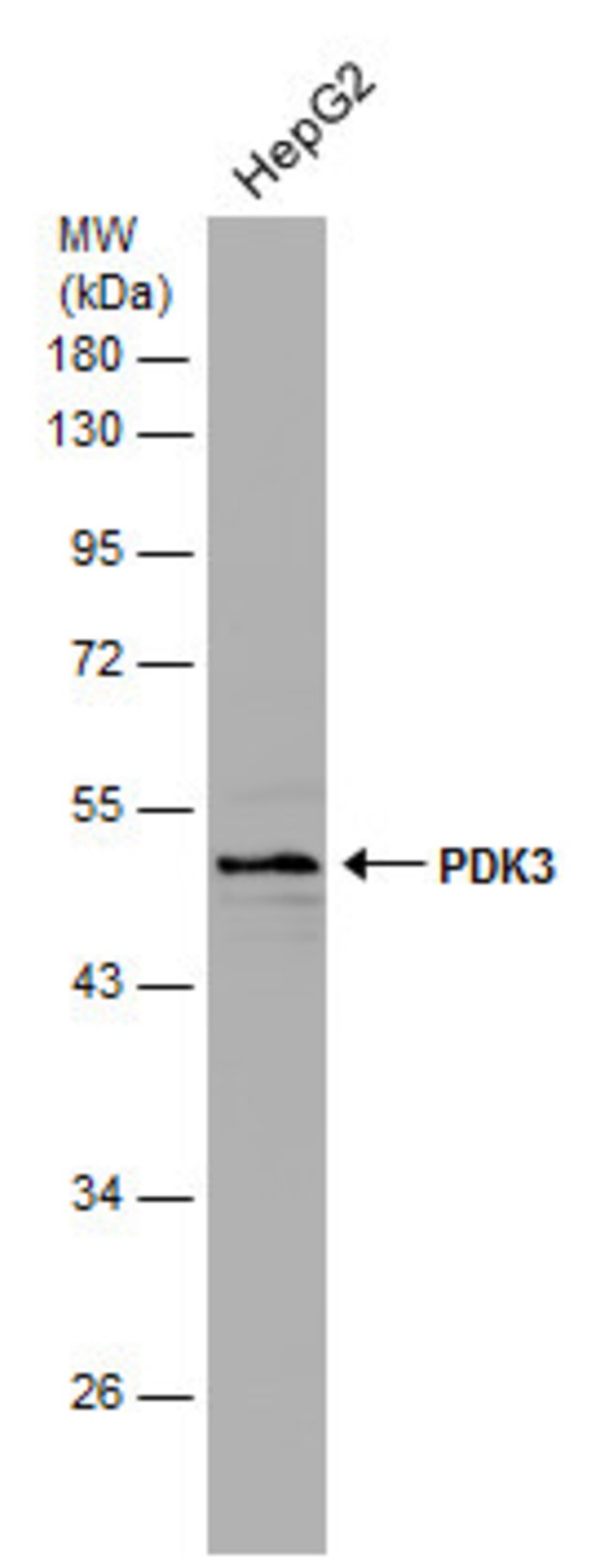 ANTI-PDK3