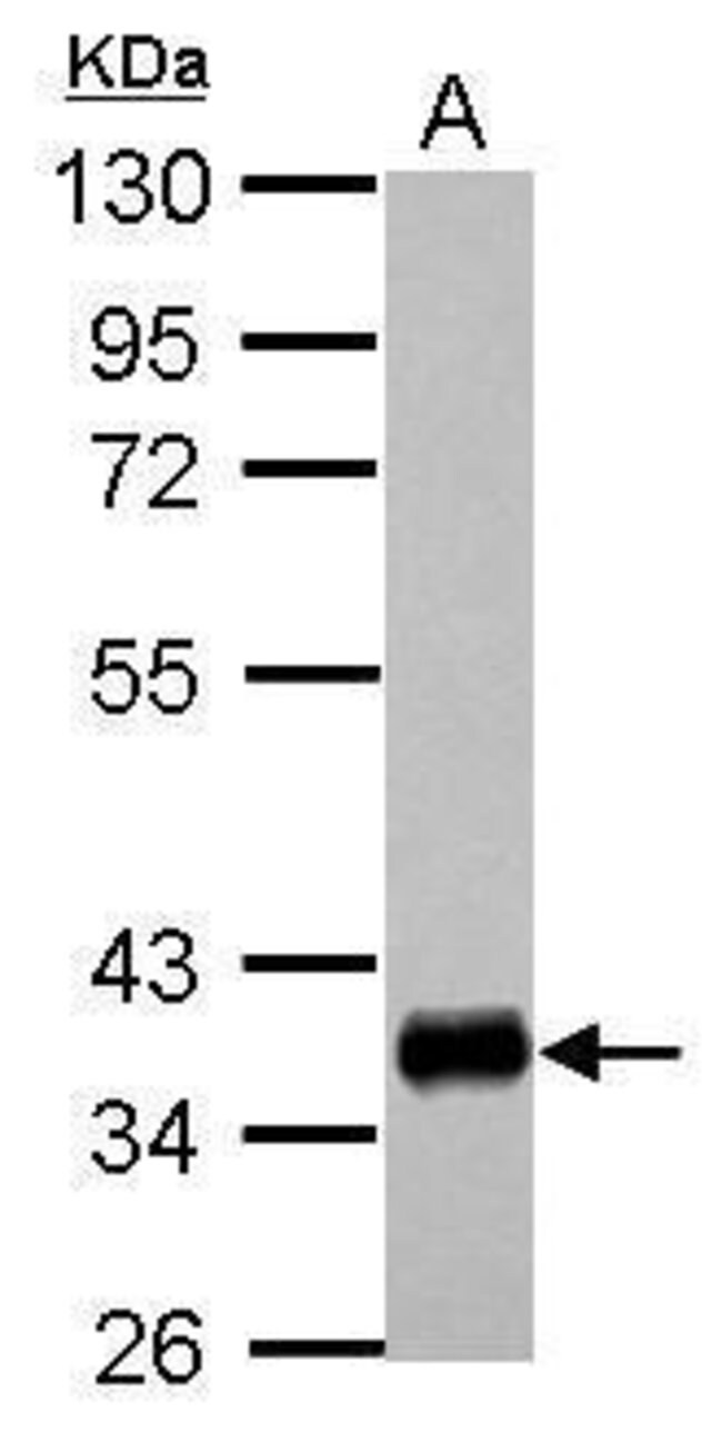 ANTI-HLA-DPA1