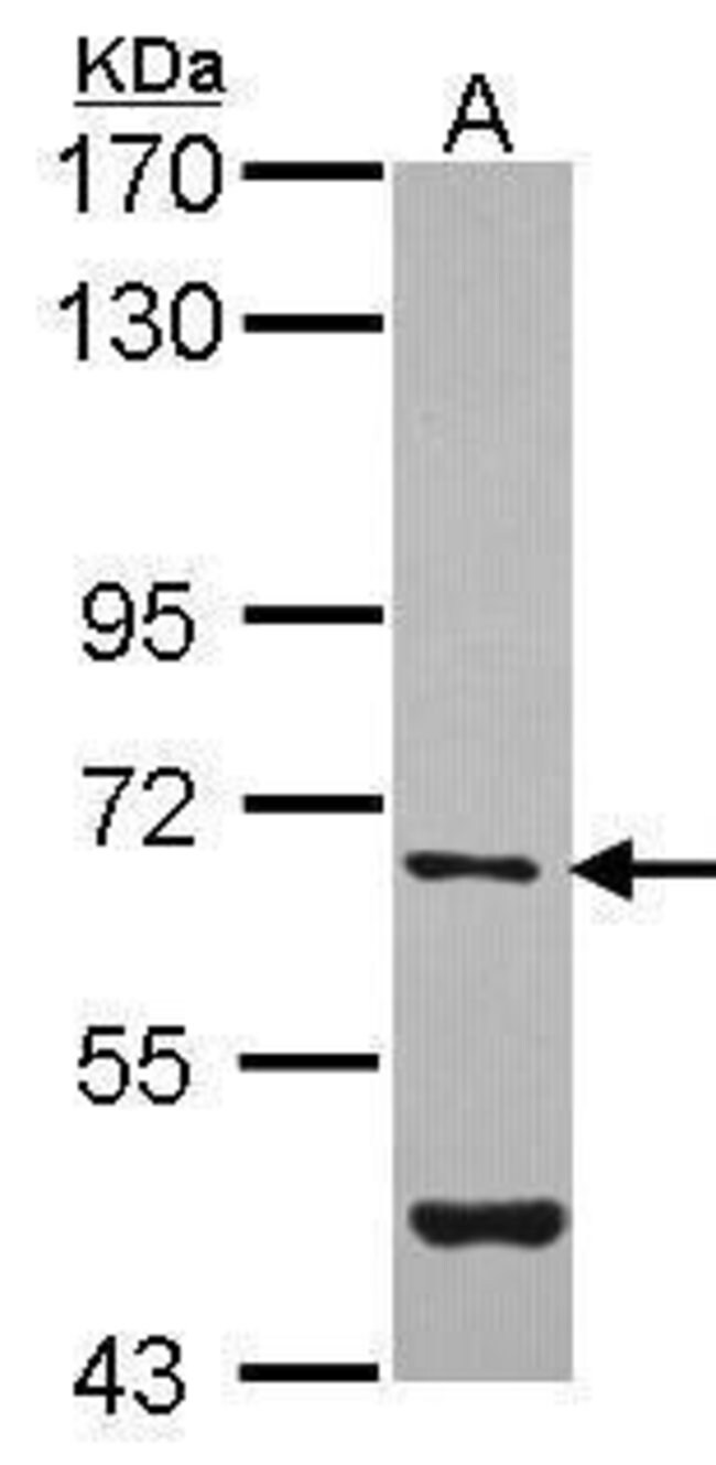 ANTI-ARYLSULFATASE G