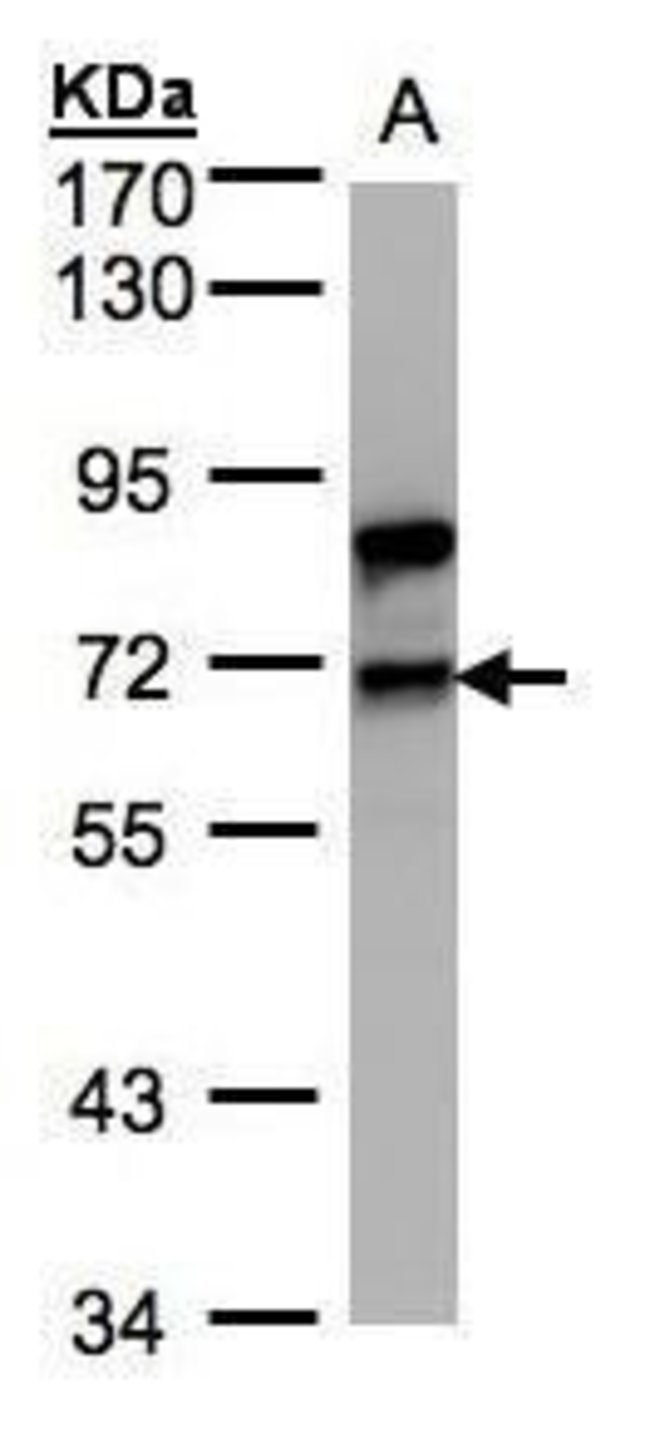 ANTI-SPLICING FACTOR 1