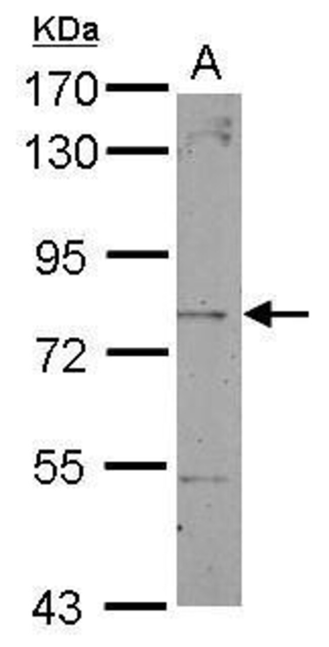 ANTI-DYSTROBREVIN BETA