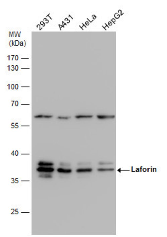 ANTI-LAFORIN