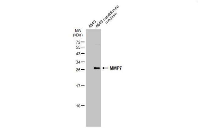 ANTI-MMP7