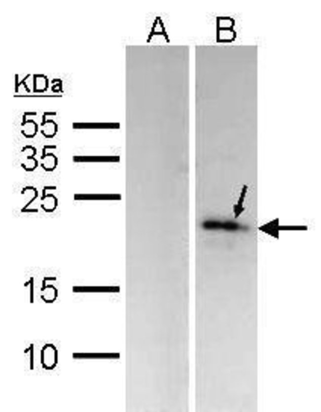 ANTI-MKP-6