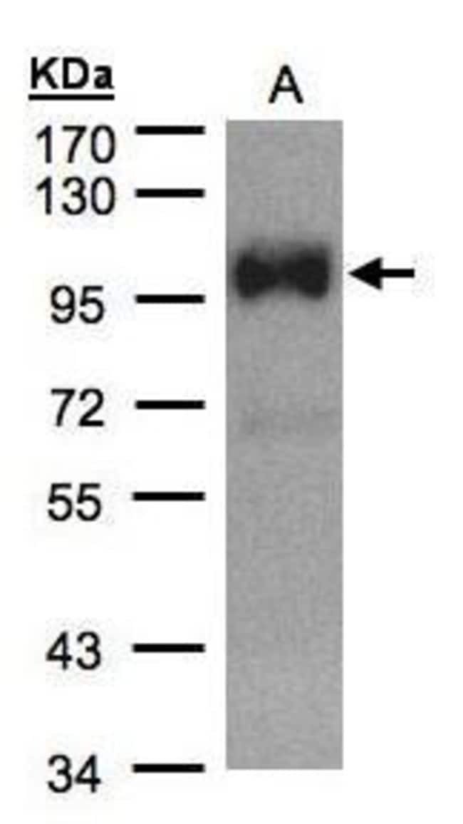 ANTI-TRPC6