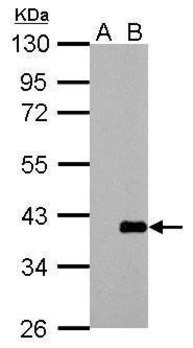 ANTI-ARPC1A