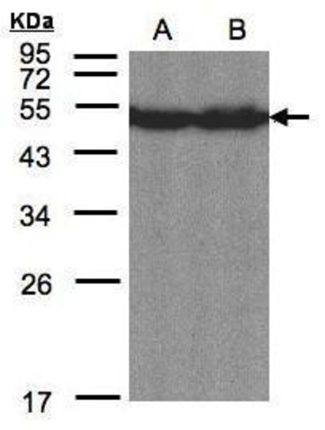 ANTI-CREB3L1