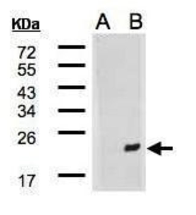 ANTI-MDG1