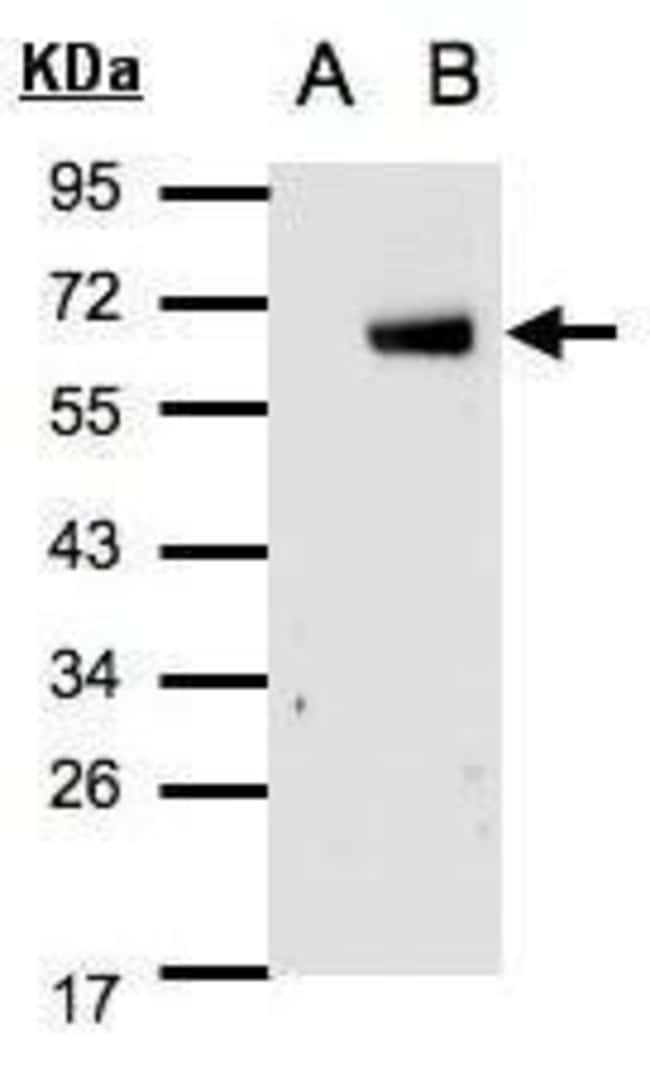 ANTI-IRF6