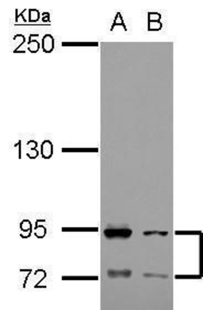 ANTI-CD89