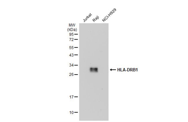 ANTI-HLA-DRB1