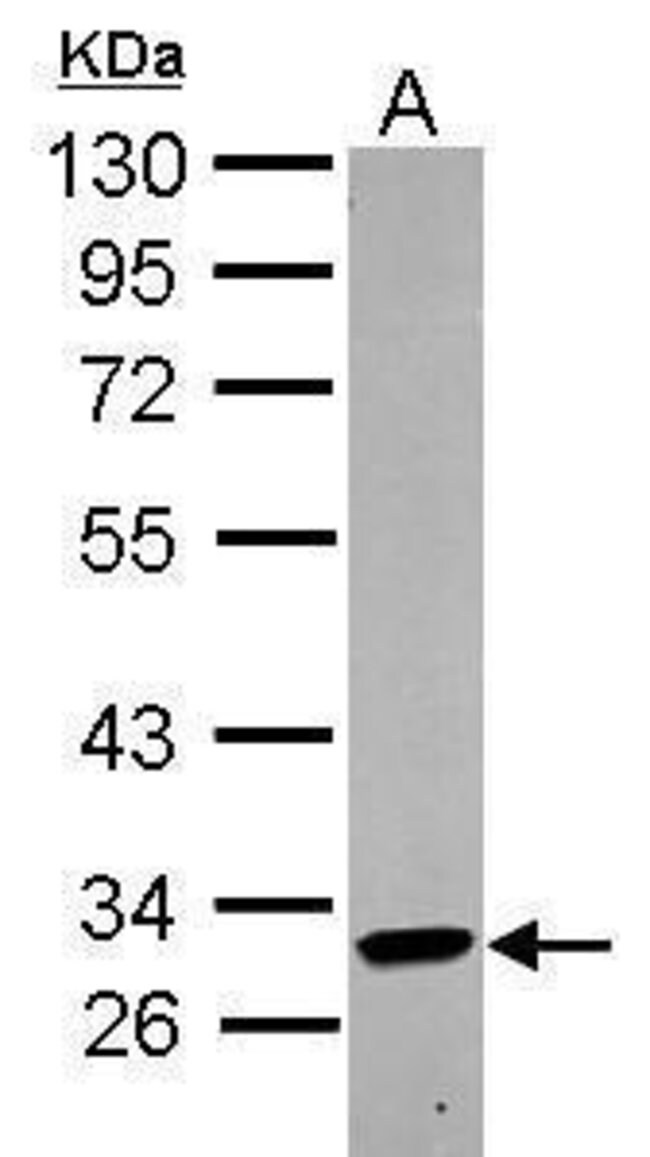 ANTI-KIR2DL4