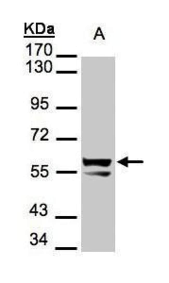 ANTI-CYTOKERATIN 6