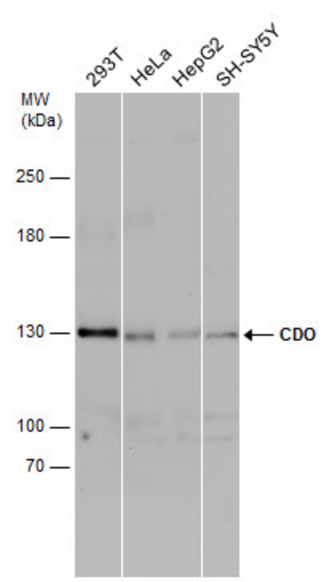 ANTI-CDO