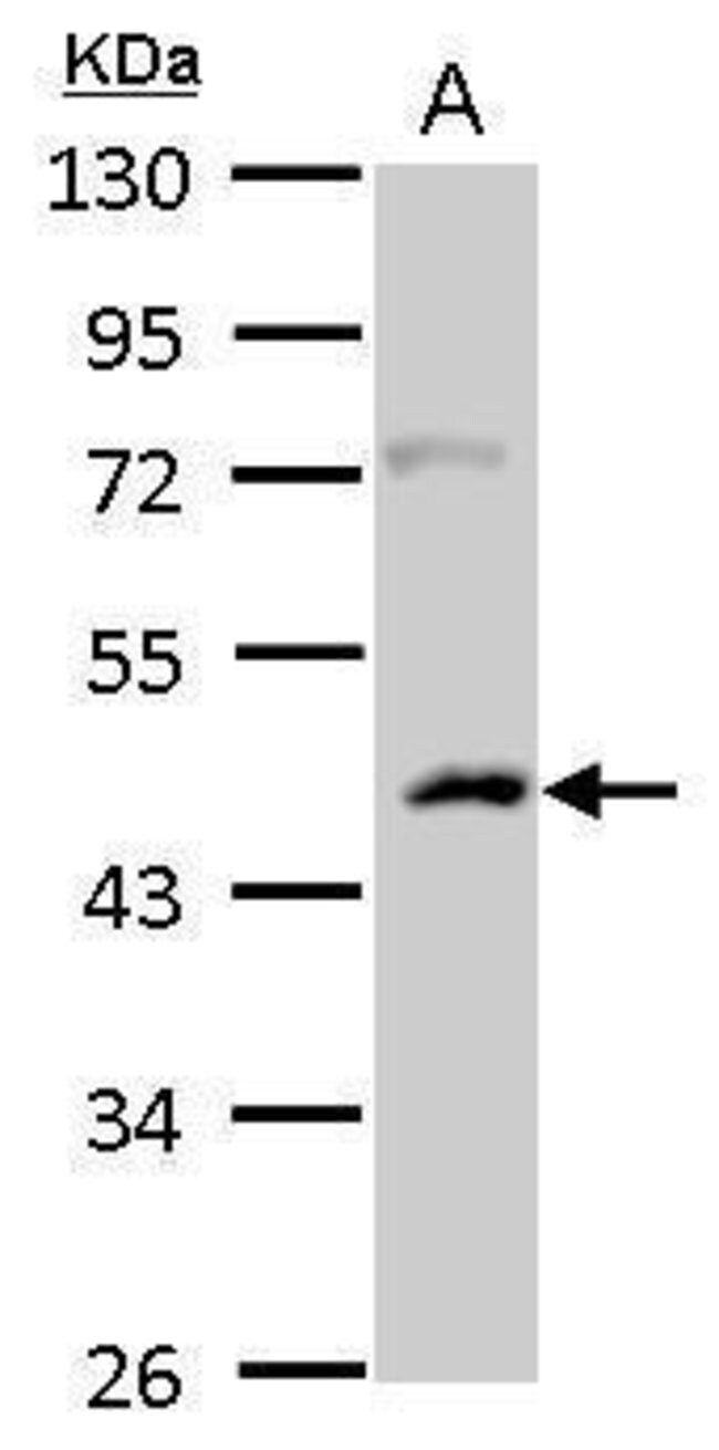 ANTI-CASEIN KINASE 1 ALPHA 1L