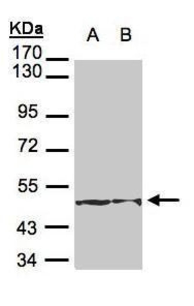 ANTI-CYTOKERATIN 18