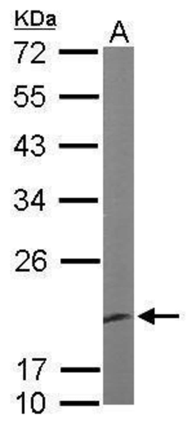 ANTI-EEF1E1